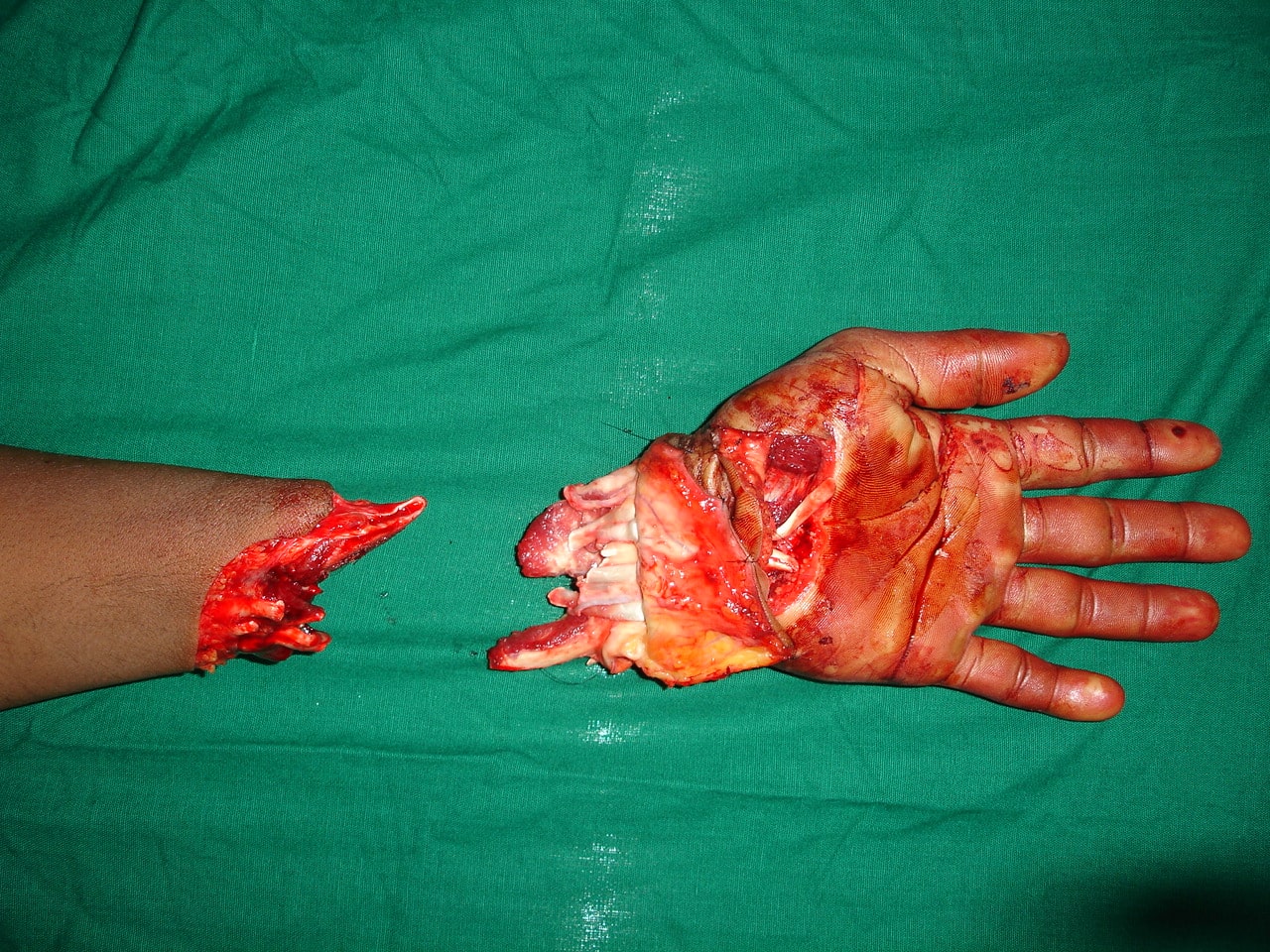 images