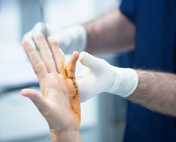 Best Hospital for hand surgery in India
