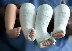 Paediatric Orthopaedic Surgery